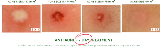 Acne from day 0 to day 7