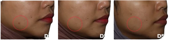 Skin at day 0, 28 and 56