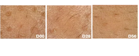 Pores at day 0, 28 and 56