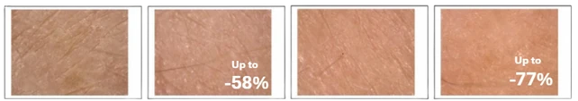 Skin smoothness at baseline, 14, 28 and 56 days